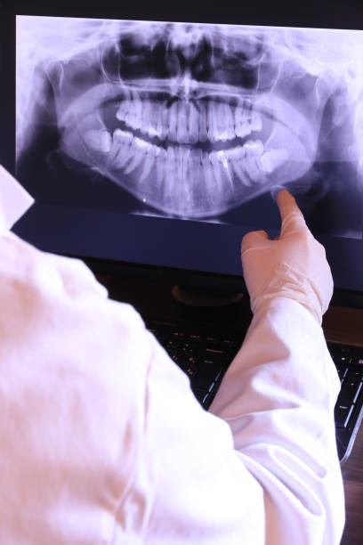 Best Emergency Tooth Extraction in Cliffside Park, NJ